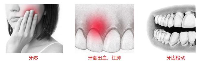 牙周病症状