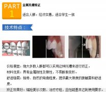 龅牙分类及龅牙矫正